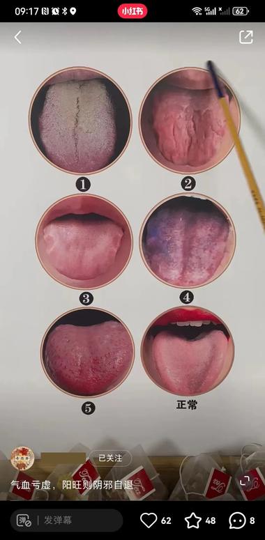 图片[3]-痛点：根据舌相卖茶！
共三篇笔记，….-网创风向标论坛-网络创业-网创圈